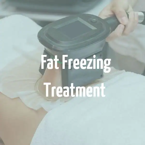 fat freezing treatment Peterborough