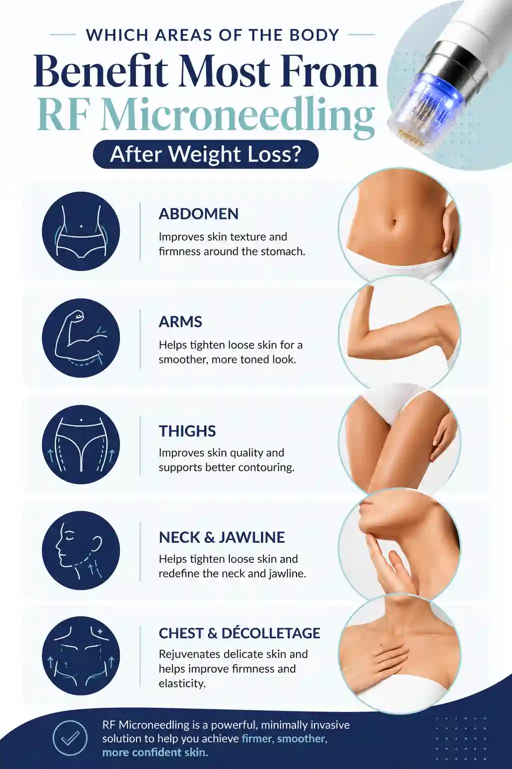 Which Areas of the Body Benefit Most From RF Microneedling After Weight Loss Peterborough